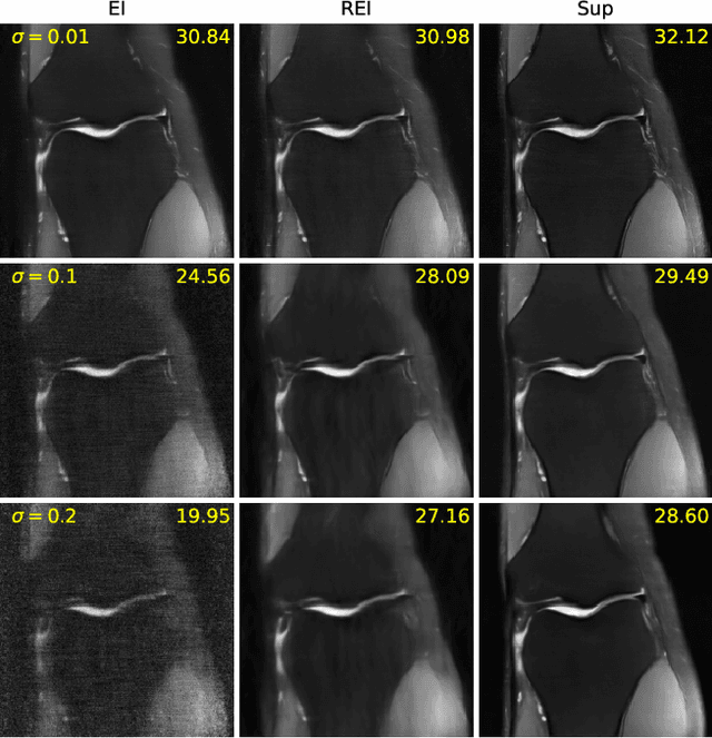 Figure 1 for Robust Equivariant Imaging: a fully unsupervised framework for learning to image from noisy and partial measurements