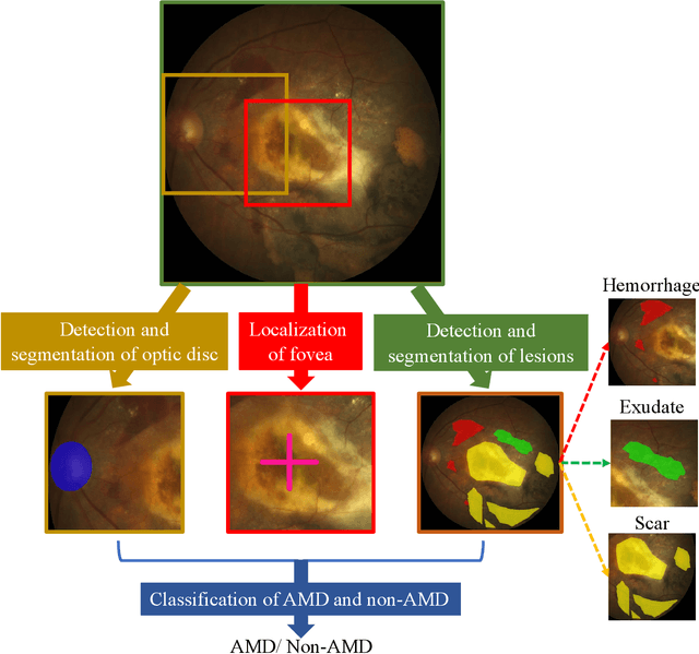 Figure 1 for ADAM Challenge: Detecting Age-related Macular Degeneration from Fundus Images