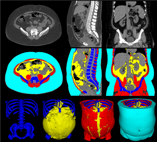 Figure 1 for Comprehensive Validation of Automated Whole Body Skeletal Muscle, Adipose Tissue, and Bone Segmentation from 3D CT images for Body Composition Analysis: Towards Extended Body Composition