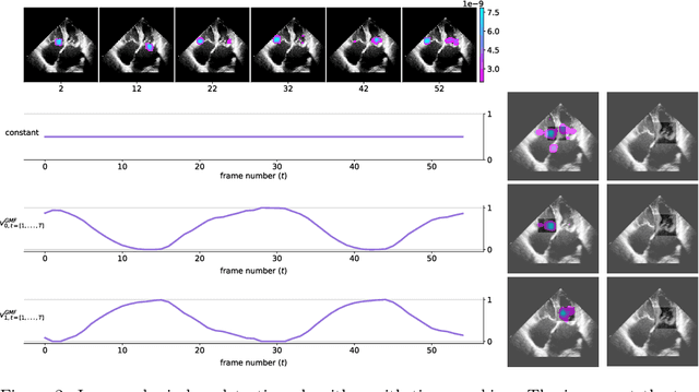 Figure 3 for Neural collaborative filtering for unsupervised mitral valve segmentation in echocardiography