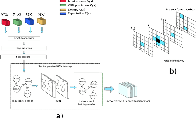 Figure 1 for An Uncertainty-Driven GCN Refinement Strategy for Organ Segmentation