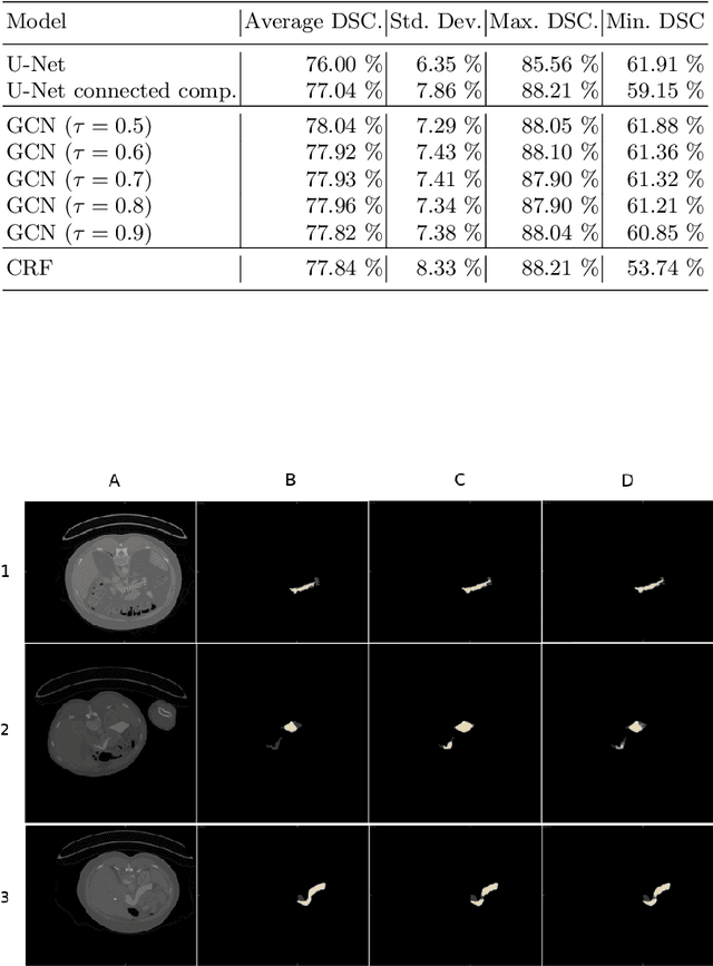 Figure 2 for An Uncertainty-Driven GCN Refinement Strategy for Organ Segmentation