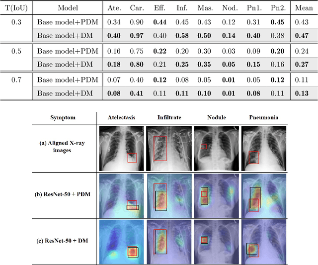 Figure 4 for Weakly Supervised Thoracic Disease Localization via Disease Masks