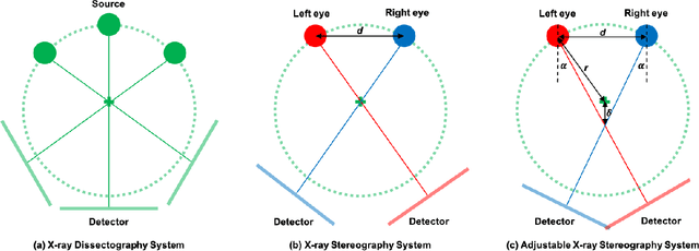 Figure 3 for X-ray Dissectography Enables Stereotography to Improve Diagnostic Performance