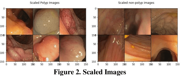 Figure 2 for Exploration of Various Deep Learning Models for Increased Accuracy in Automatic Polyp Detection