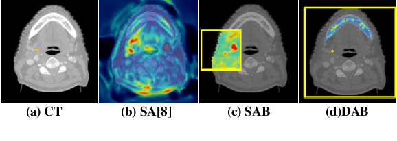 Figure 1 for Local block-wise self attention for normal organ segmentation