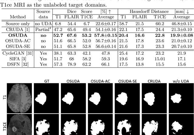 Figure 4 for Adapting Off-the-Shelf Source Segmenter for Target Medical Image Segmentation