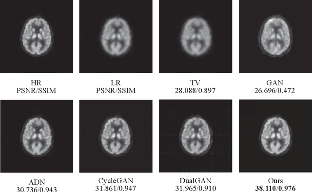 Figure 2 for Quasi-supervised Learning for Super-resolution PET