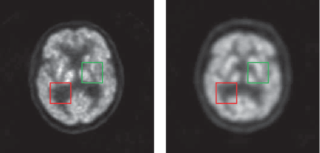 Figure 1 for Quasi-supervised Learning for Super-resolution PET