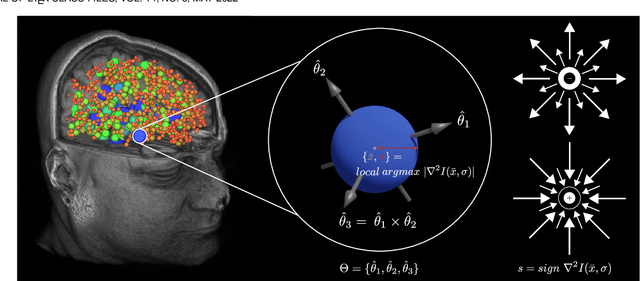 Figure 1 for Registering Image Volumes using 3D SIFT and Discrete SP-Symmetry