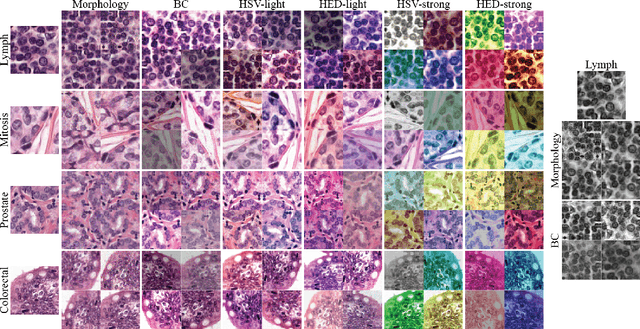 Figure 2 for Quantifying the effects of data augmentation and stain color normalization in convolutional neural networks for computational pathology