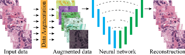 Figure 4 for Quantifying the effects of data augmentation and stain color normalization in convolutional neural networks for computational pathology