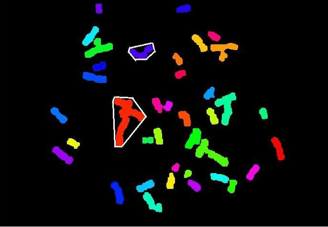 Figure 1 for A Geometric Approach For Fully Automatic Chromosome Segmentation