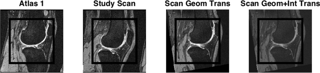 Figure 3 for Simple Methods for Scanner Drift Normalization Validated for Automatic Segmentation of Knee Magnetic Resonance Imaging - with data from the Osteoarthritis Initiative