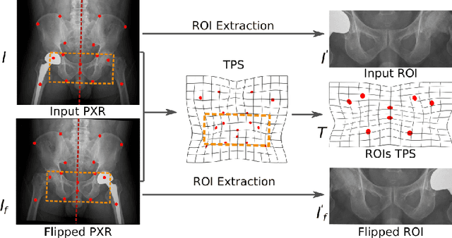 Figure 3 for Anatomy-Aware Siamese Network: Exploiting Semantic Asymmetry for Accurate Pelvic Fracture Detection in X-ray Images