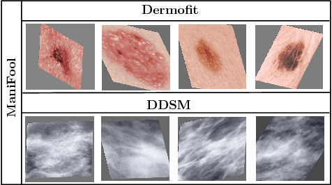 Figure 3 for Data Augmentation with Manifold Exploring Geometric Transformations for Increased Performance and Robustness