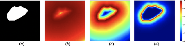 Figure 1 for Focal Attention Networks: optimising attention for biomedical image segmentation