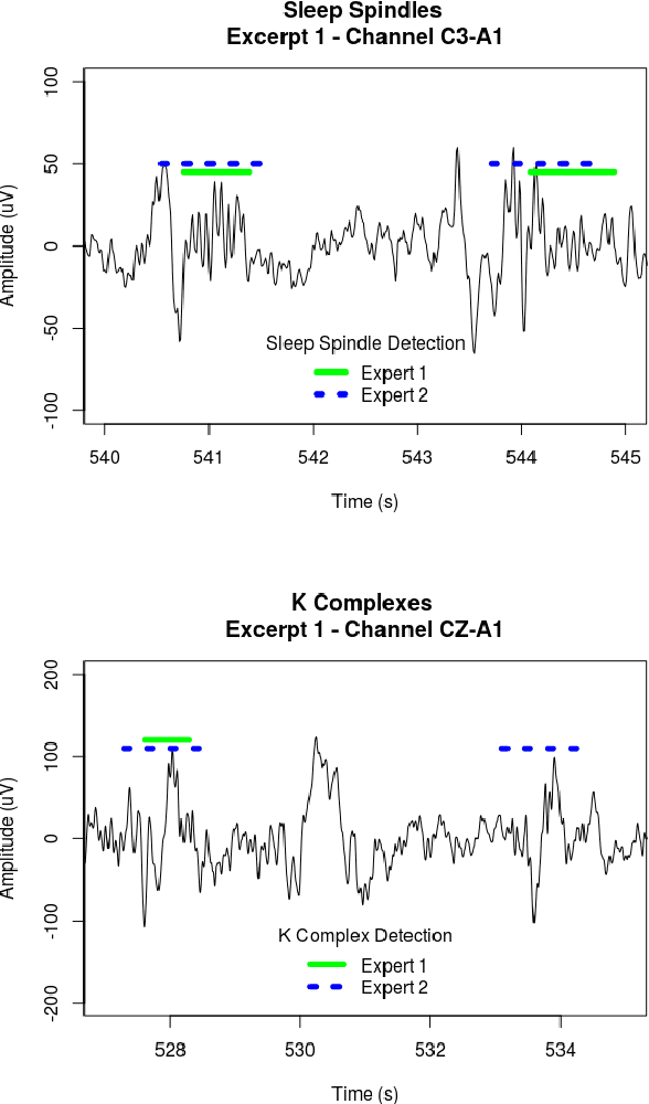 Figure 3 for Classification of EEG Signals using Genetic Programming for Feature Construction