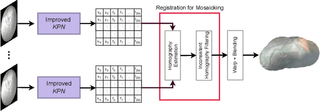 Figure 3 for Learning-Based Keypoint Registration for Fetoscopic Mosaicking