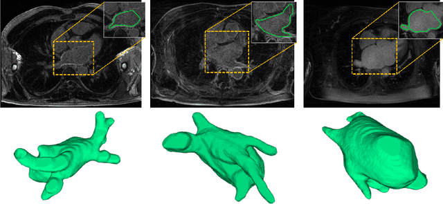 Figure 1 for Pyramid Network with Online Hard Example Mining for Accurate Left Atrium Segmentation