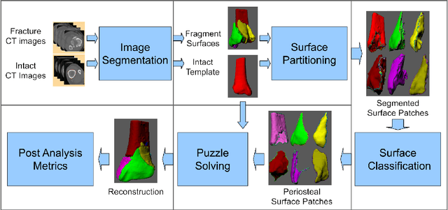 Figure 1 for A System for 3D Reconstruction Of Comminuted Tibial Plafond Bone Fractures