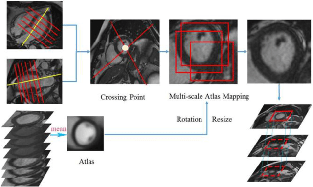 Figure 2 for Multi-views Fusion CNN for Left Ventricular Volumes Estimation on Cardiac MR Images