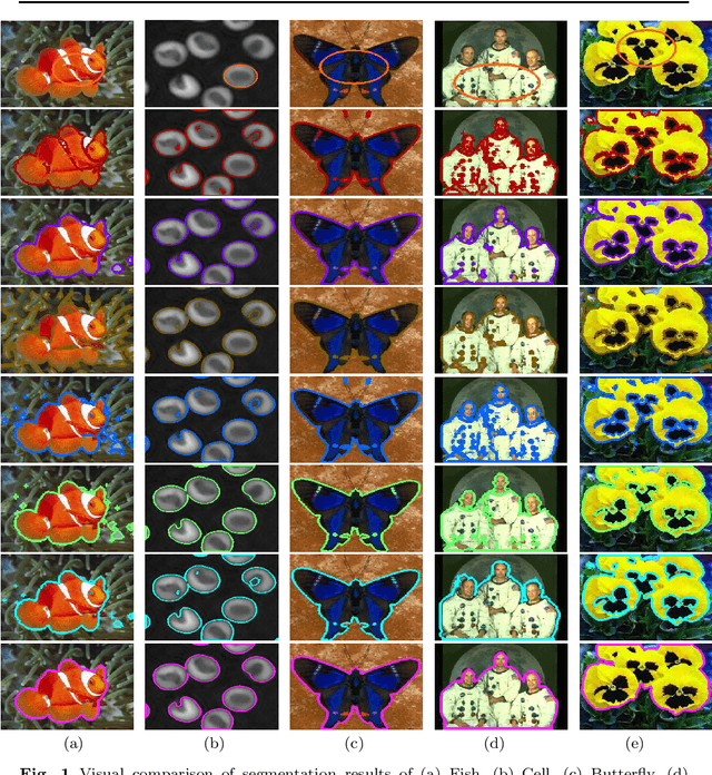 Figure 2 for State-of-The-Art Fuzzy Active Contour Models for Image Segmentation