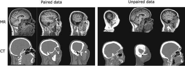 Figure 1 for Deep MR to CT Synthesis using Unpaired Data