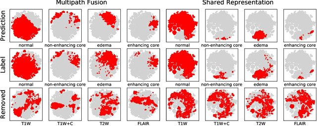 Figure 3 for Multi-modal segmentation with missing MR sequences using pre-trained fusion networks