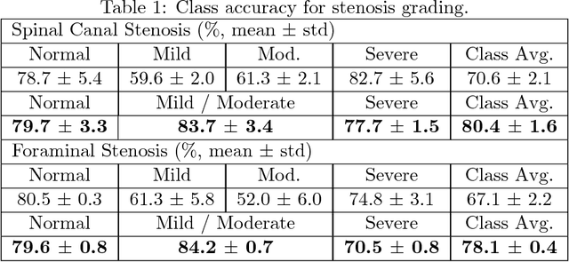 Figure 2 for DeepSPINE: Automated Lumbar Vertebral Segmentation, Disc-level Designation, and Spinal Stenosis Grading Using Deep Learning