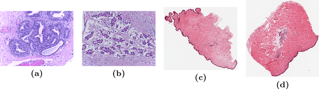 Figure 3 for Monte-Carlo Sampling applied to Multiple Instance Learning for Histological Image Classification