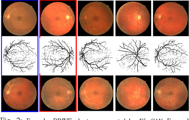 Figure 3 for Synthesizing Filamentary Structured Images with GANs