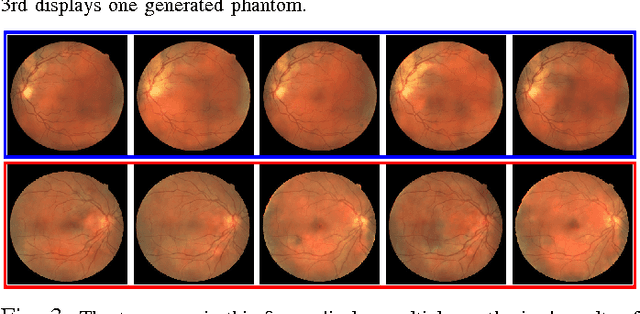 Figure 4 for Synthesizing Filamentary Structured Images with GANs