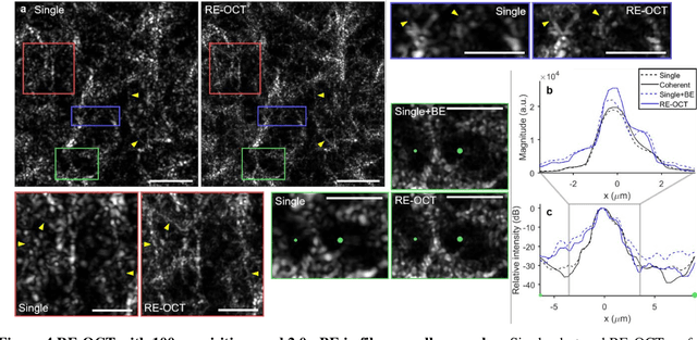 Figure 4 for Resolution-enhanced OCT and expanded framework of information capacity and resolution in coherent imaging