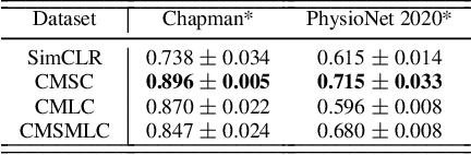 Figure 2 for CLOCS: Contrastive Learning of Cardiac Signals