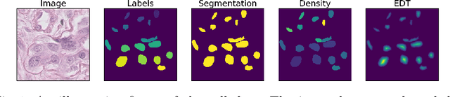 Figure 1 for As easy as 1, 2 4? Uncertainty in counting tasks for medical imaging