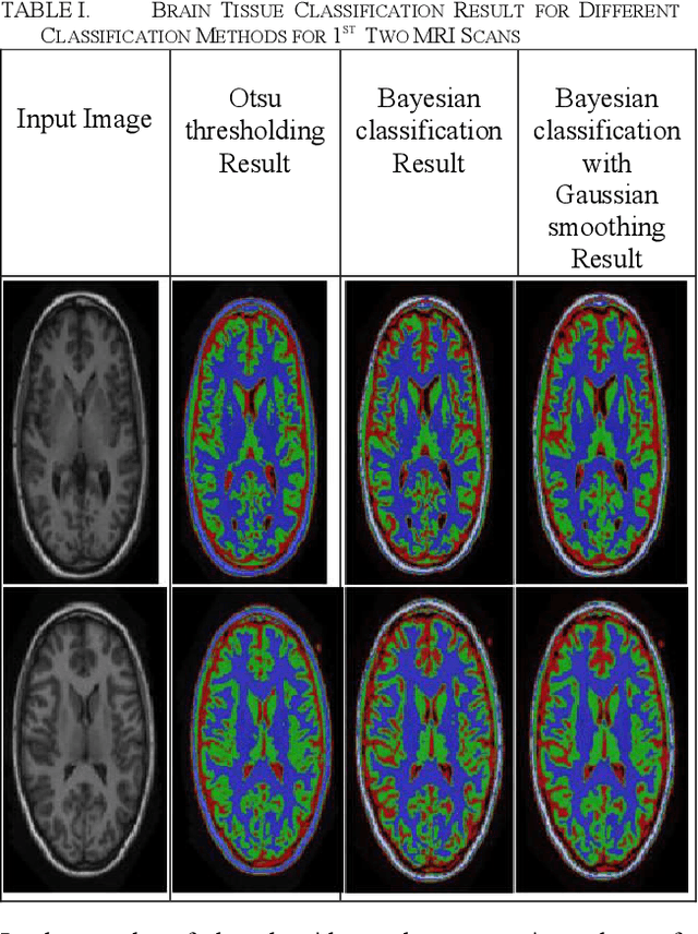 Figure 1 for Unsupervised Segmentation Algorithms' Implementation in ITK for Tissue Classification via Human Head MRI Scans