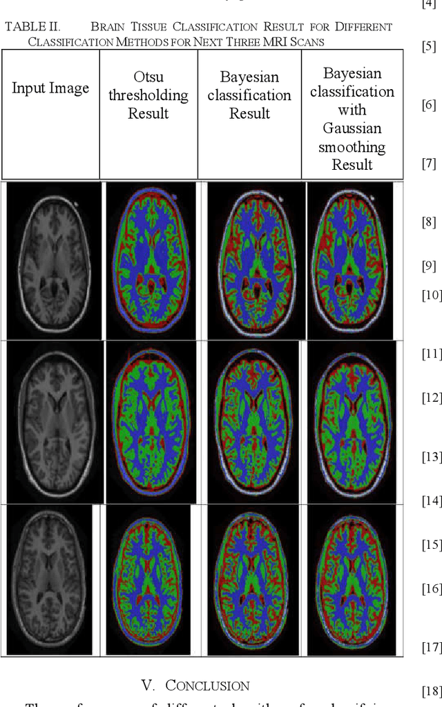 Figure 2 for Unsupervised Segmentation Algorithms' Implementation in ITK for Tissue Classification via Human Head MRI Scans