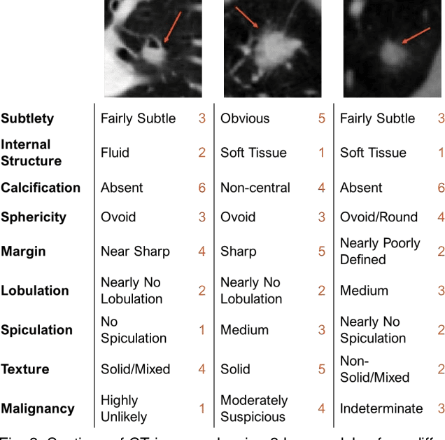 Figure 3 for Attention-Enhanced Cross-Task Network for Analysing Multiple Attributes of Lung Nodules in CT