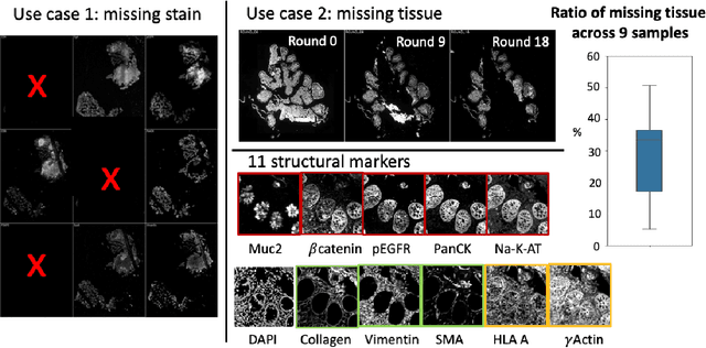 Figure 1 for Random Multi-Channel Image Synthesis for Multiplexed Immunofluorescence Imaging