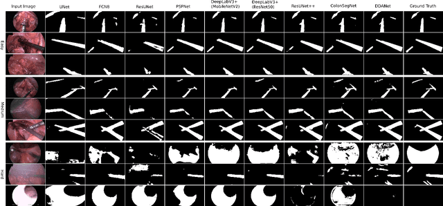 Figure 1 for Exploring Deep Learning Methods for Real-Time Surgical Instrument Segmentation in Laparoscopy