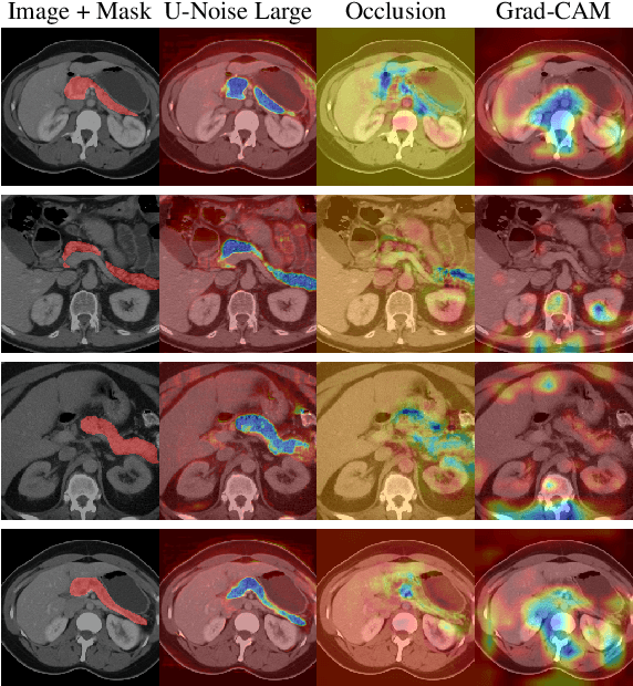 Figure 3 for U-Noise: Learnable Noise Masks for Interpretable Image Segmentation