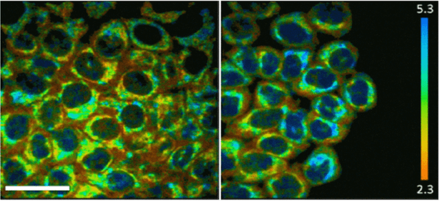 Figure 4 for Machine learning for faster and smarter fluorescence lifetime imaging microscopy