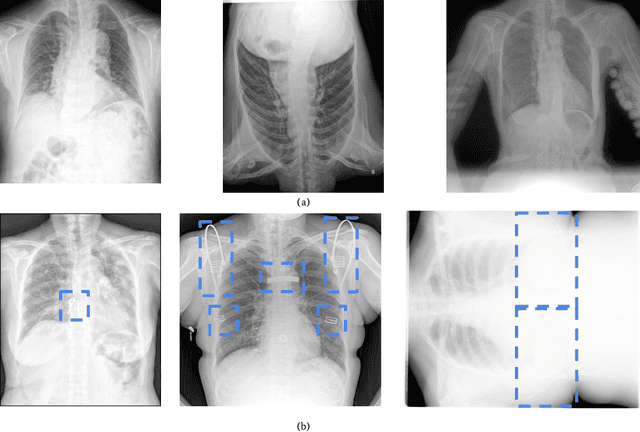 Figure 4 for Shifted Windows Transformers for Medical Image Quality Assessment