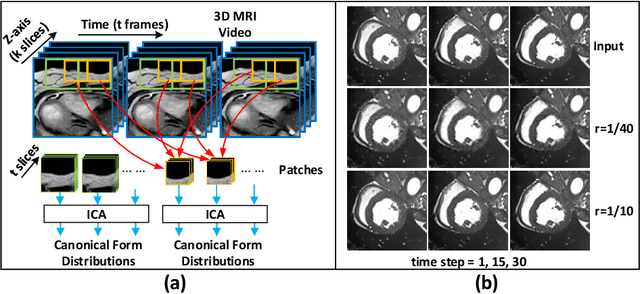 Figure 1 for MSU-Net: Multiscale Statistical U-Net for Real-time 3D Cardiac MRI Video Segmentation