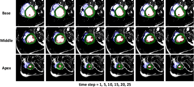 Figure 3 for MSU-Net: Multiscale Statistical U-Net for Real-time 3D Cardiac MRI Video Segmentation