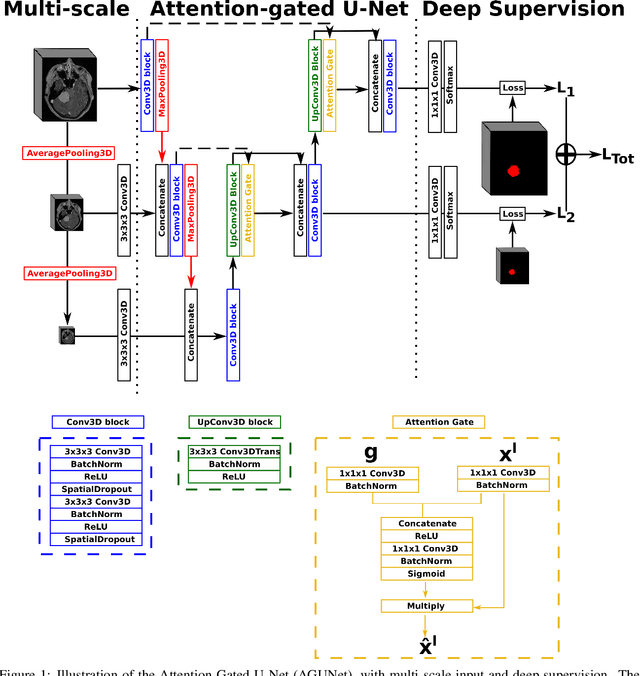 Figure 1 for Meningioma segmentation in T1-weighted MRI leveraging global context and attention mechanisms