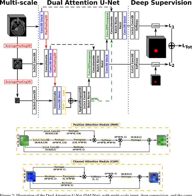 Figure 2 for Meningioma segmentation in T1-weighted MRI leveraging global context and attention mechanisms