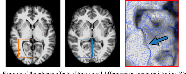 Figure 1 for Spot the Difference: Topological Anomaly Detection via Geometric Alignment