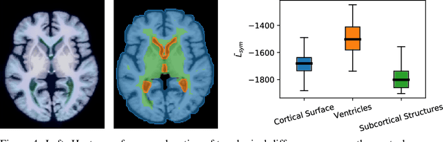 Figure 4 for Spot the Difference: Topological Anomaly Detection via Geometric Alignment